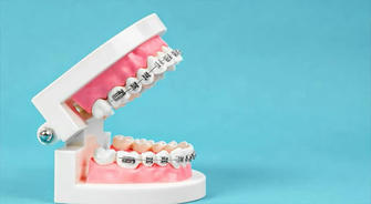 About orthodontic treatment:The truth you must know